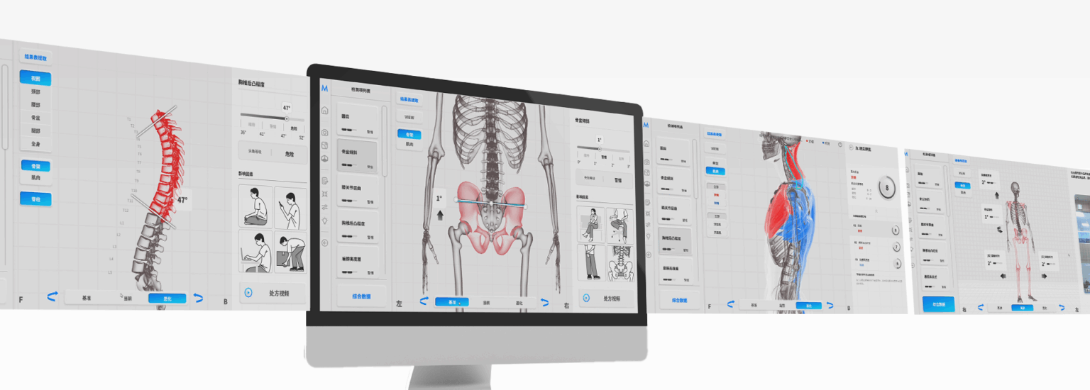 Moti physio – 3D analiza posture