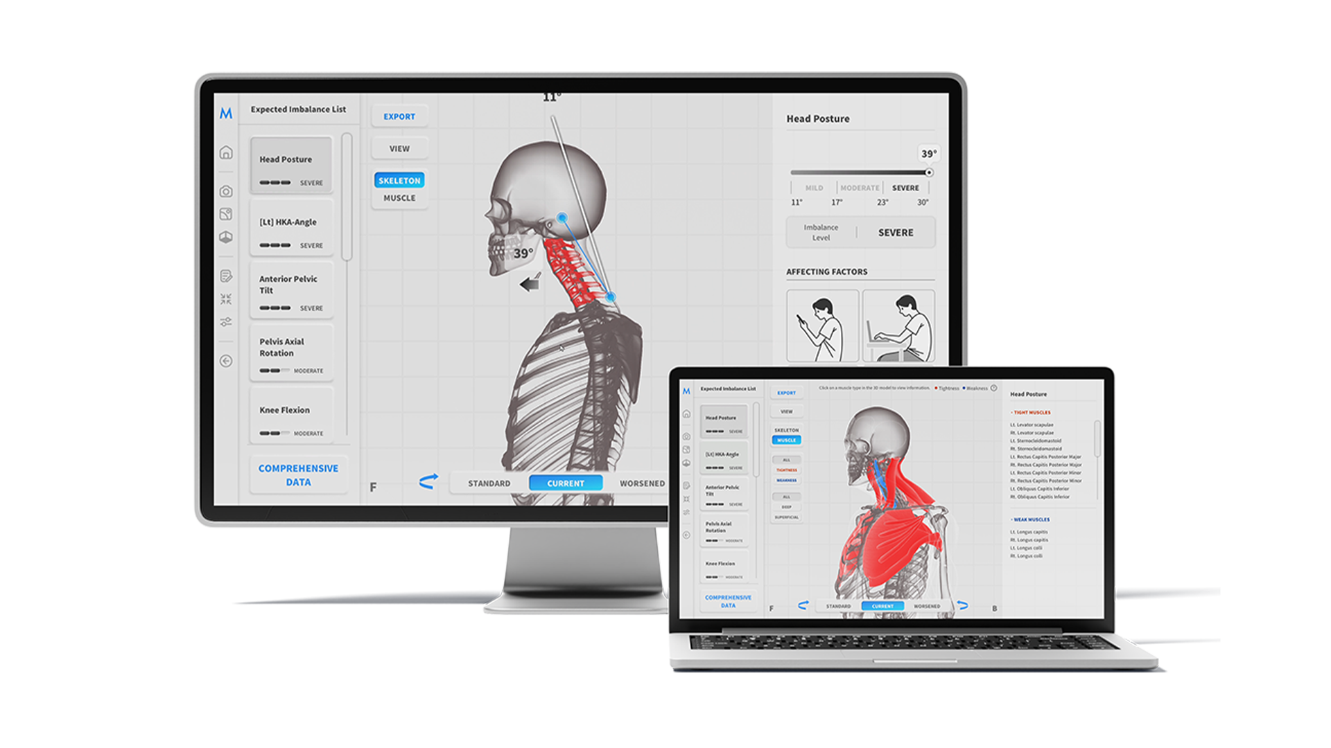 MOTI Physio prikaz rezultata na monitoru