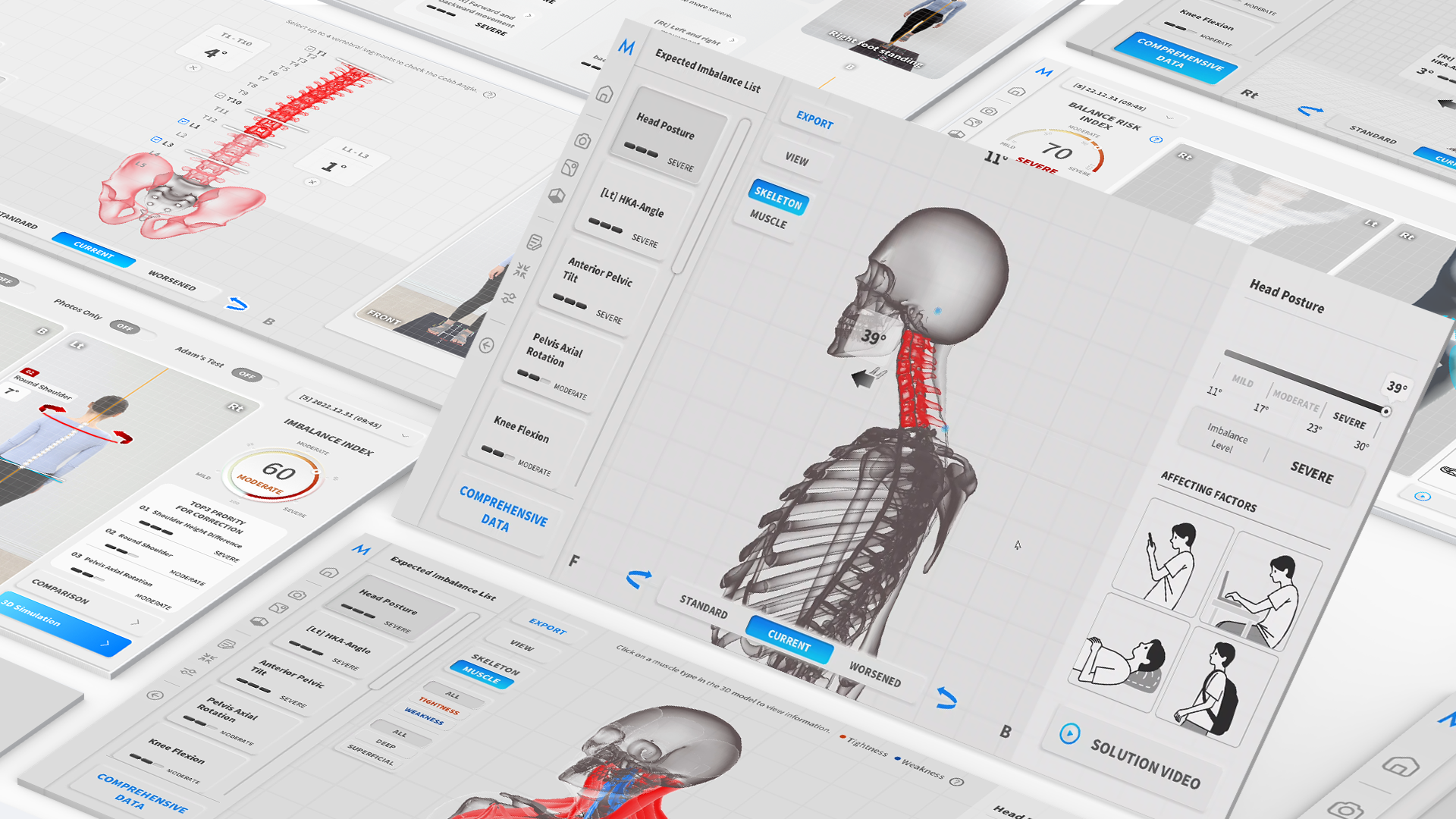 MOTI Physio 3D analiza posture i prikaz rezultata